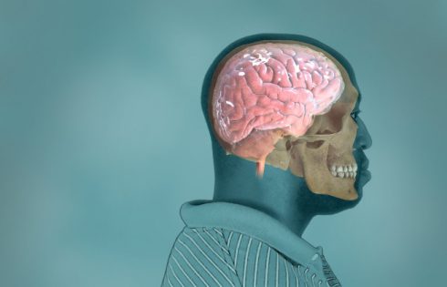 Как лечить сотрясение головного мозга дома - советы от известного невролога