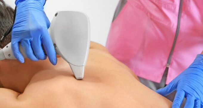 Лазерная эпиляция спины у женщин: показания, подготовка, преимущества
